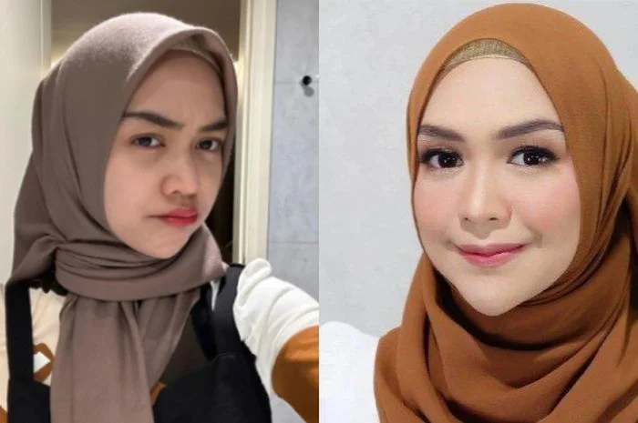Ria Ricis Ungkap Operasi Hidung, Pengeluaran Ratusan Juta, dan Kepedulian pada Kasus Kekerasan Daycare